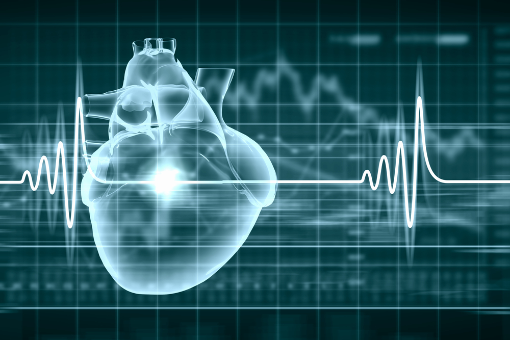 Cardiac imaging analysis