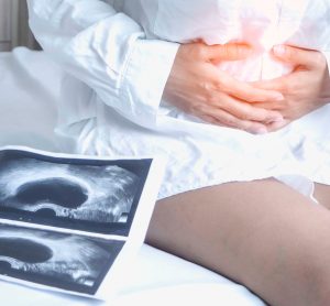 Woman holding stomach in pain next to scan of uterus