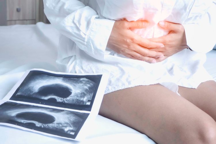 Woman holding stomach in pain next to scan of uterus