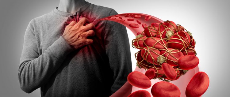 Illustration of blood clot with man holding chest in the background