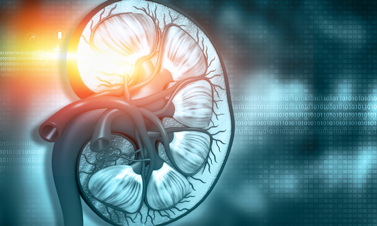 nephrotoxicity image