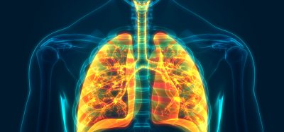 3D medical illustration showing human lungs highlighted in orange and yellow, depicting inflammation or disease within the respiratory system