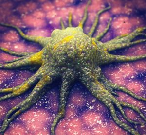 Cancer cell metastasis