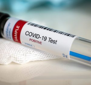 Positive COVID-19 test