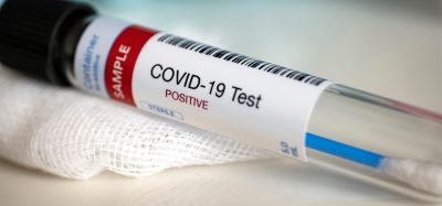 Positive COVID-19 test
