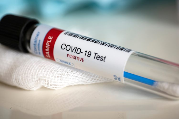 Positive COVID-19 test