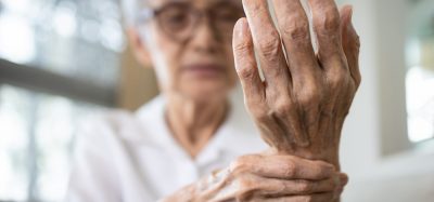 Woman with arthritis holding wrist