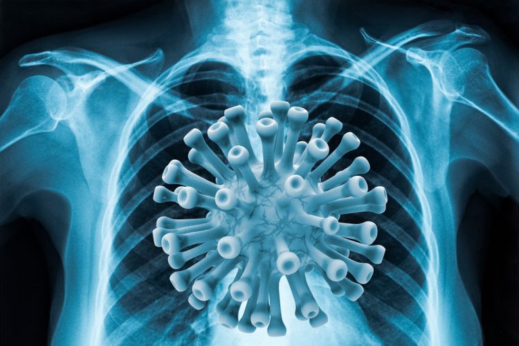 COVID-19 in lungs