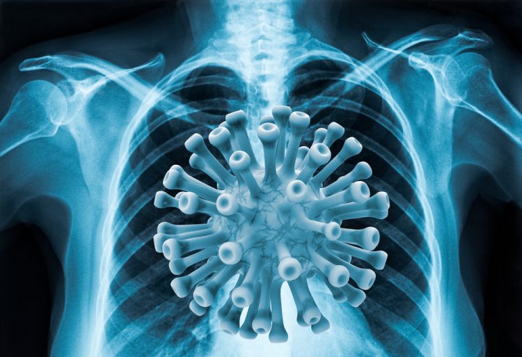 COVID-19 in lungs