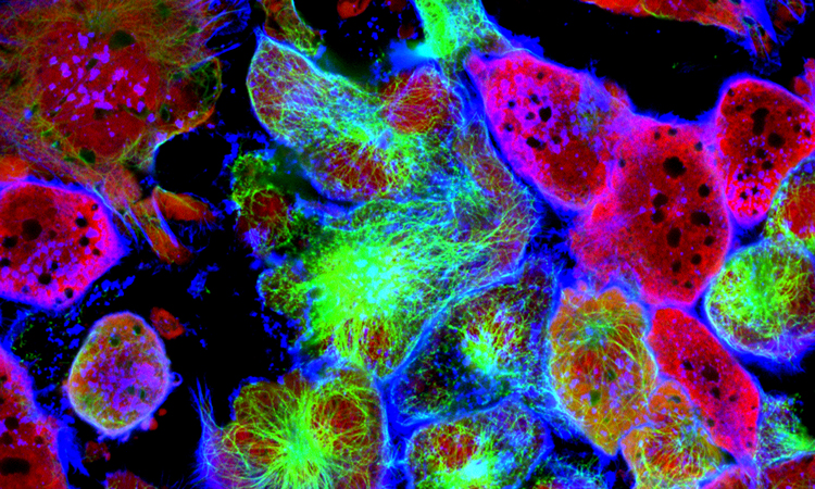 new research cancer stem cells