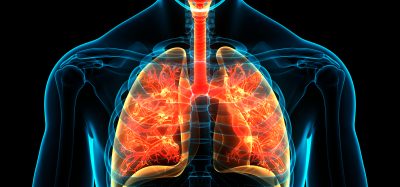 Medical illustration of the human chest showing the lungs and branching airways highlighted to represent inflammation and lung disease.