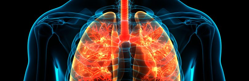 Medical illustration of the human chest showing the lungs and branching airways highlighted to represent inflammation and lung disease.