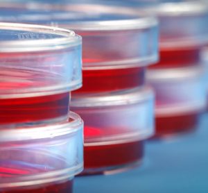 Image showing Stack of petri dishes with samples of biological cultures