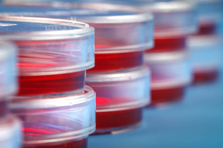 Image showing Stack of petri dishes with samples of biological cultures