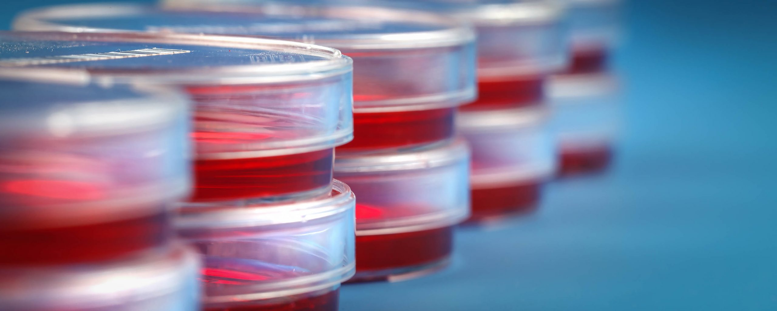 Image showing Stack of petri dishes with samples of biological cultures