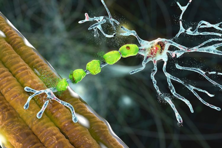 3D illustration of degradation of motor neuron