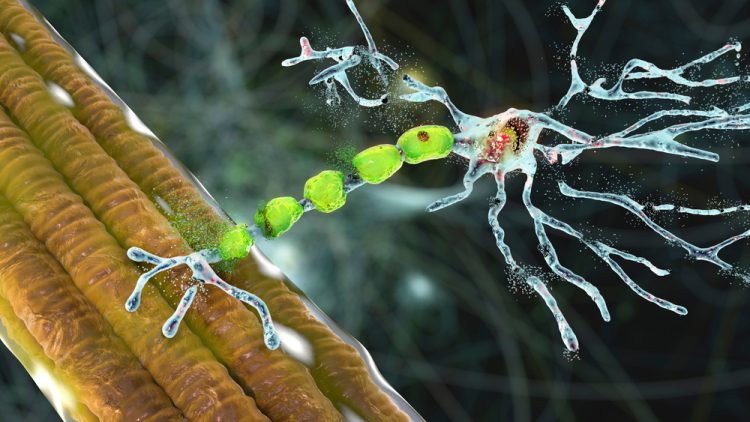 3D illustration of degradation of motor neuron