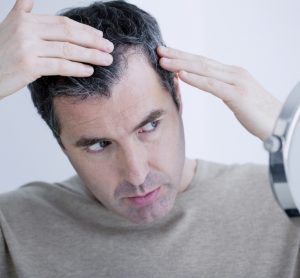 Hair loss