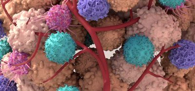 Illustration of the tumour microenvironment showing cancer cells interacting with immune cells and blood vessels within surrounding tissue.