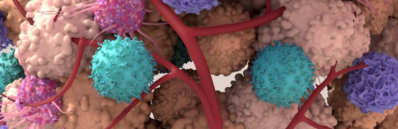 Illustration of the tumour microenvironment showing cancer cells interacting with immune cells and blood vessels within surrounding tissue.