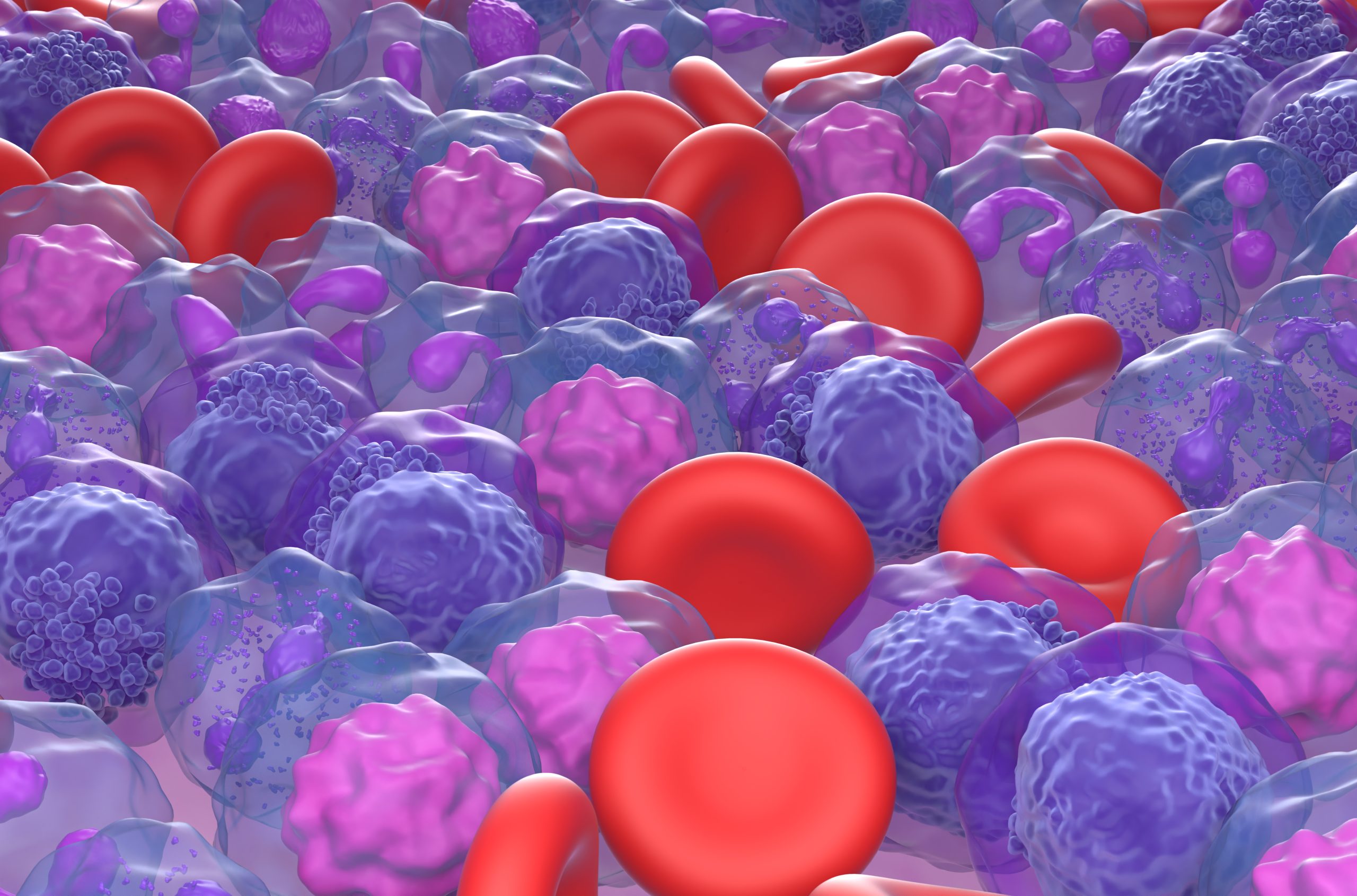 acute myeloid leukaemia