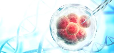 cell line development