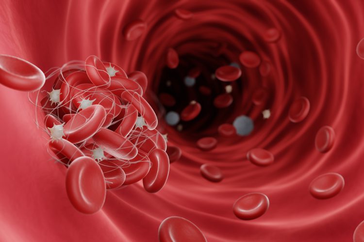 Blood clots (fibrin clots) are usually formed to stop the bleeding during injury, Blood clots can be dangerouse when they obstruct blood flow and cause thrombosis, 3d illustration