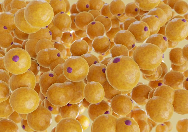 fat cell build-up