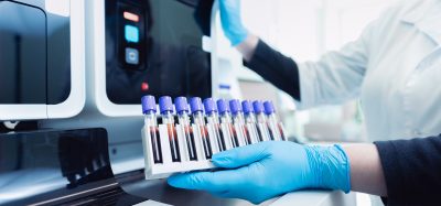 Scientist loading blood sample tubes into an automated laboratory analyser in a drug discovery lab.