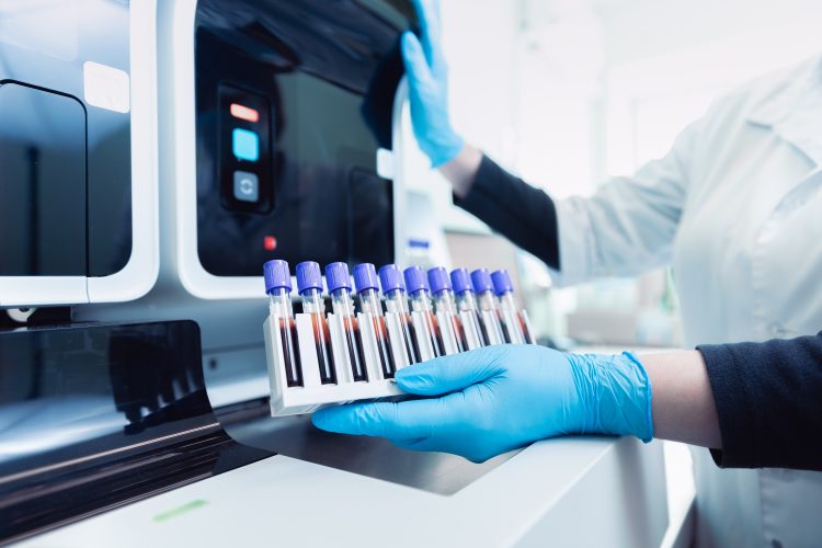 Scientist loading blood sample tubes into an automated laboratory analyser in a drug discovery lab.