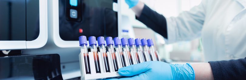 Scientist loading blood sample tubes into an automated laboratory analyser in a drug discovery lab.