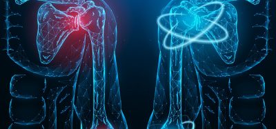 Digital illustration of human shoulder and elbow joints showing inflammation in red on the left side and healthy joints in blue on the right side, symbolizing immune-mediated inflammatory disease and treatment response
