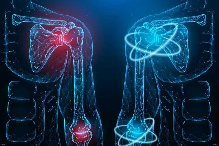 Digital illustration of human shoulder and elbow joints showing inflammation in red on the left side and healthy joints in blue on the right side, symbolizing immune-mediated inflammatory disease and treatment response