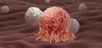 Chimeric Antigen Receptor (CAR) T-cell therapy