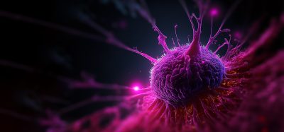 3D illustration of a cancer cell for oncology and drug discovery research.