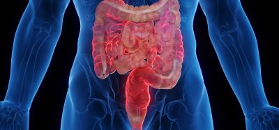 Crohn's disease