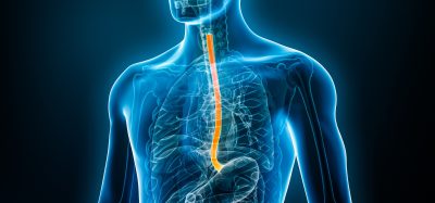 Organoids take on ESCC’s toughest tumours