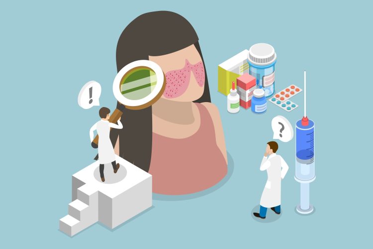 Illustration of lupus diagnosis and treatment challenges. A doctor examines a woman with a butterfly-shaped facial rash using a magnifying glass, while another doctor stands near various medications and a large syringe, appearing uncertain.

