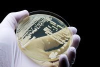 Laboratory culture of fungal pathogens such as Candida auris used in antifungal resistance research.