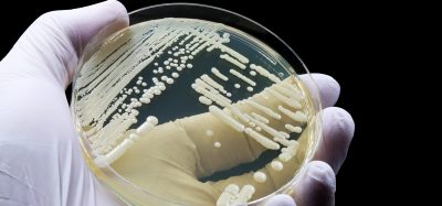 Laboratory culture of fungal pathogens such as Candida auris used in antifungal resistance research.
