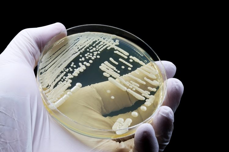 Laboratory culture of fungal pathogens such as Candida auris used in antifungal resistance research.