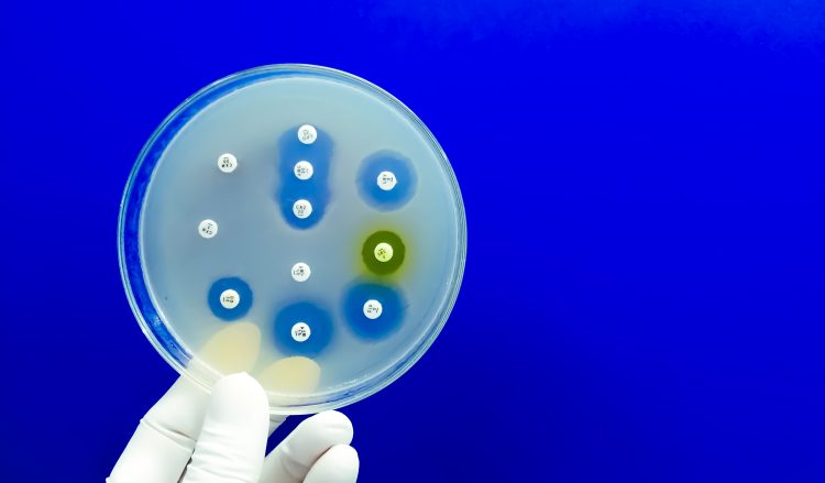 Antibiotic resistance shown in petri dish.