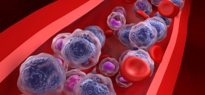 Illustration of leukaemic cells and red blood cells circulating inside a blood vessel, representing acute myeloid leukaemia in the bloodstream.
