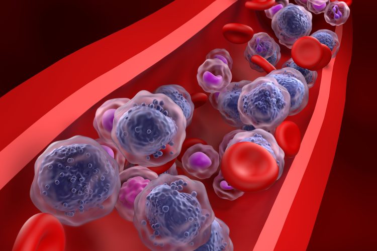 Illustration of leukaemic cells and red blood cells circulating inside a blood vessel, representing acute myeloid leukaemia in the bloodstream.