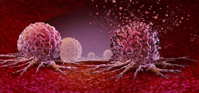 3D illustration of cancer cells spreading and releasing particles, representing tumour progression and cancer research.
