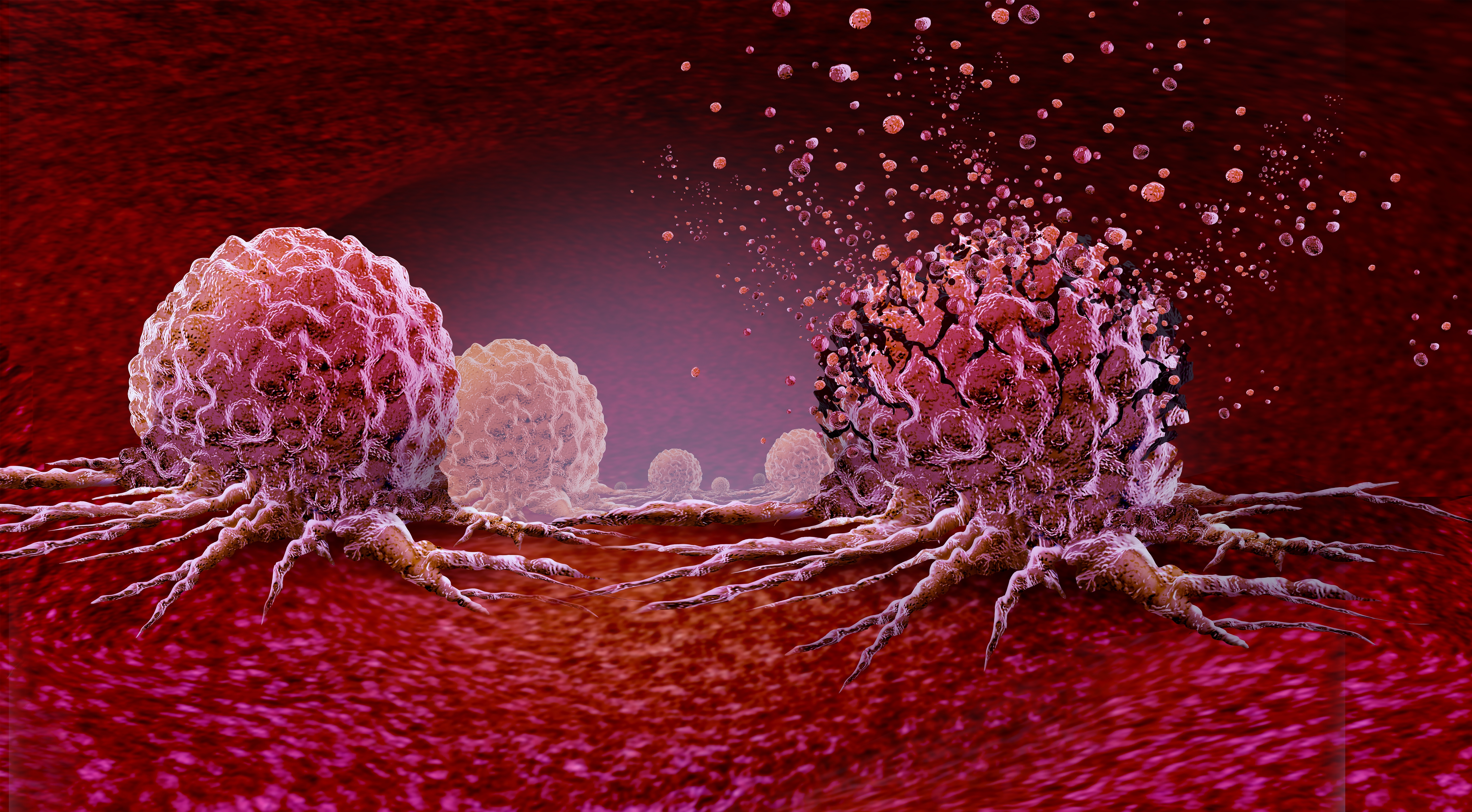 3D illustration of cancer cells spreading and releasing particles, representing tumour progression and cancer research.