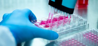 Scientist using a multi-channel pipette to transfer samples into a microplate for laboratory assay testing.