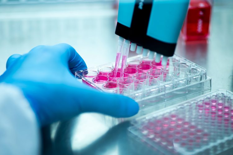 Scientist using a multi-channel pipette to transfer samples into a microplate for laboratory assay testing.