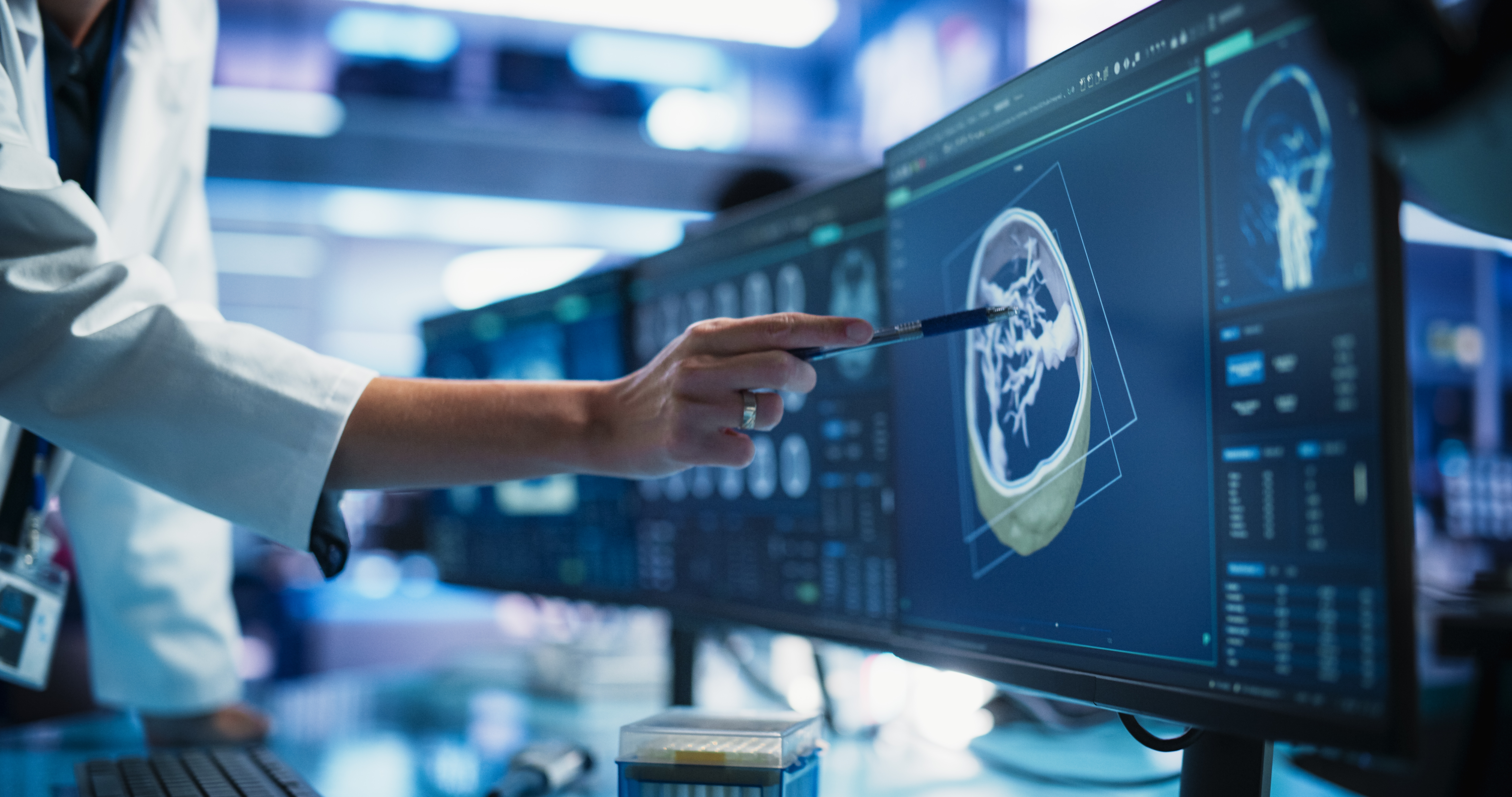 Breakthrough glioblastoma research wins £400k charity funding