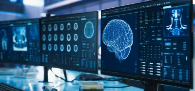 Computer monitors displaying digital visualisations of the human brain used in neuroscience research.